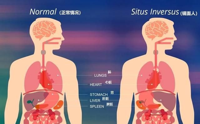 内脏器官反着长的“镜面人”到底是什么